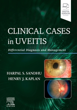 【预订】Clinical Cases in Uveitis: Differential Diagnosis and Management