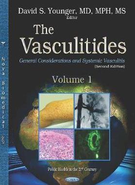 [预订]The Vasculitides. Volume 1: General Considerations and Systemic Vasculitis (Second Edition) 9781536151336