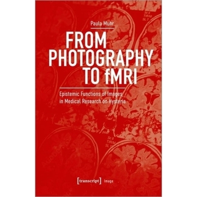 预订 From Photography to fMRI: Epistemic Functions of Images in Medical Research on Hysteria 从摄影到功能磁共振成像: 978