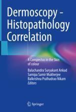 [预订]Dermoscopy - Histopathology Correlation 9789813346376
