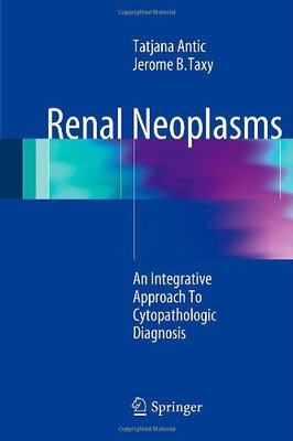 【预订】Renal Neoplasms