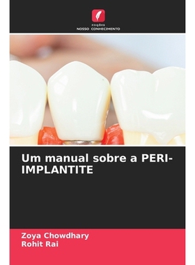 预订 Um manual sobre a PERI-IMPLANTITE: 9786209338526