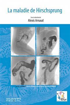 [预订]La maladie de Hirschsprung 9791030303698