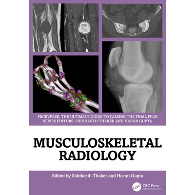 预订 Musculoskeletal Radiology: An Ultimate Guide to Passing the Final FRCR: 9781032815152