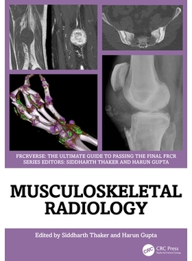 预订 Musculoskeletal Radiology: An Ultimate Guide to Passing the Final FRCR: 9781032815152