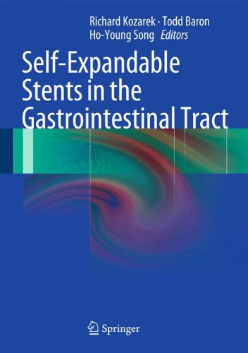 【预订】Self-Expandable Stents in the Gastrointestinal Tract
