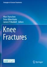 【预订】Knee Fractures 9783030817787