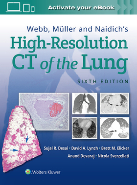 【预订】Webb, Müller and Naidich’s High-Resolution CT of the Lung