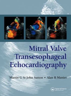 【预订】Mitral Valve Transesophageal Echocardiography