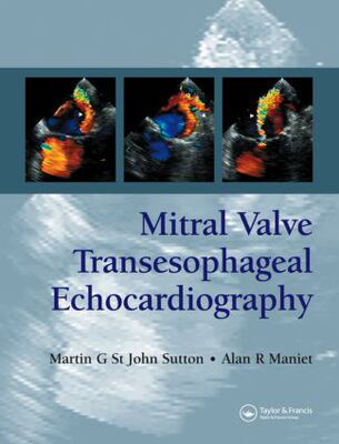 【预订】Mitral Valve Transesophageal Echocardiography