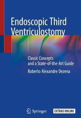 预订 Endoscopic Third Ventriculostomy