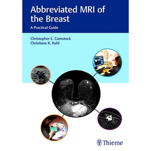 乳房 9781626231931 Practical Breast MRI the 简化MRI 预订 Guide Abbreviated