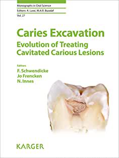 【预售】Caries Excavation: Evolution of Treating Cavitated Carious Lesions