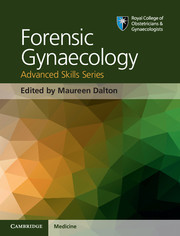 【预订】Forensic Gynaecology