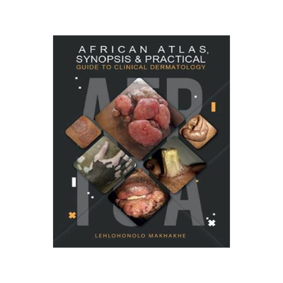 [预订]African Atlas, Synopsis & Practical Guide to Clinical Dermatology 9780639953915