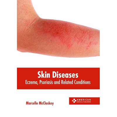 预订 Skin Diseases: Eczema, Psoriasis and Related Conditions