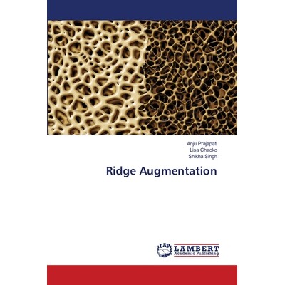 预订 Ridge Augmentation 脊扩张: 9786202802314