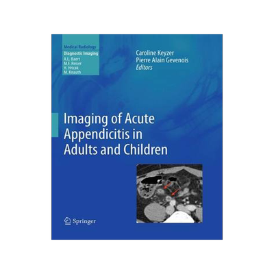 预订 Imaging of Acute Appendicitis in Adults and Children