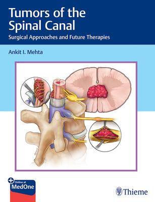 [预订]Tumors of the Spinal Canal 9781626239319