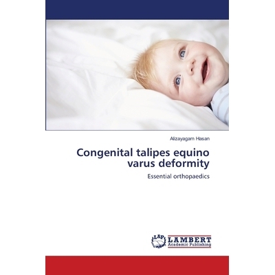 预订 Congenital talipes equino varus deformity: Essential orthopaedics: 9786139829453