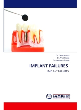 预订 IMPLANT FAILURES 植入失败: 9786207474547