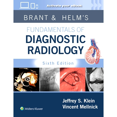 Print + eBook with Multimedia