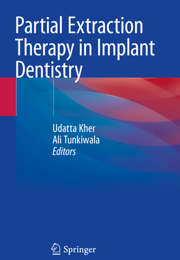 预订 Partial Extraction Therapy in Implant Dentistry