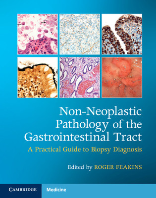 【预订】Non-Neoplastic Pathology of the Gastrointestinal Tract with Online Resource