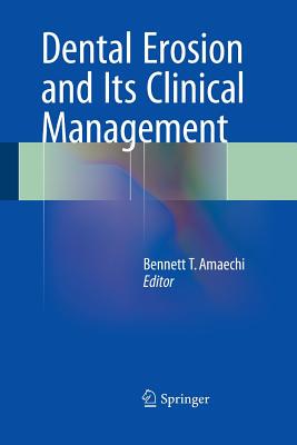 【预订】Dental Erosion and Its Clinical Management