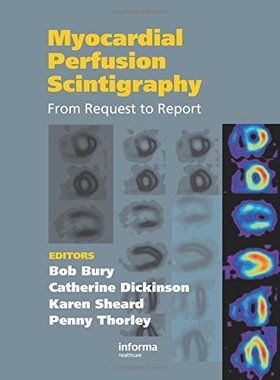 【预订】Myocardial Perfusion Scintigraphy