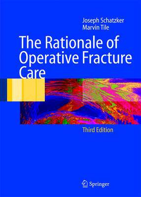 预订 The Rationale of Operative Fracture Care
