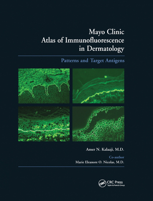 【预订】Mayo Clinic Atlas of Immunofluorescence in Dermatology: Patterns and Target Antigens