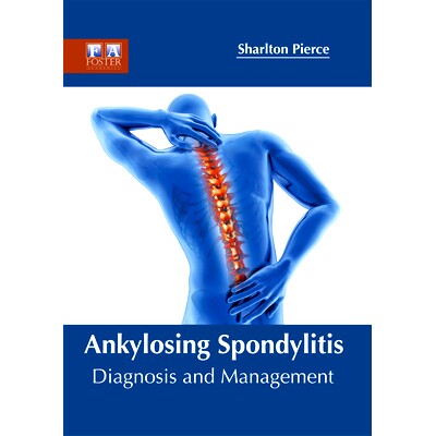 预订 Ankylosing Spondylitis: Diagnosis and Management 强直性脊柱炎：诊断和处理: 9781632424891