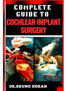 预订 Complete Guide to Cochlear Implant Surgery: Comprehensive Manual To Advanced Techniques, Patient Care, And Optimize
