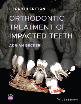 [预订]Orthodontic Treatment of Impacted Teeth 4/e