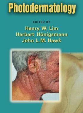 【预订】Photodermatology