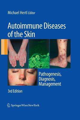 【预订】Autoimmune Diseases of the Skin