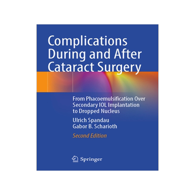 [预订]Complications During and After Cataract Surgery