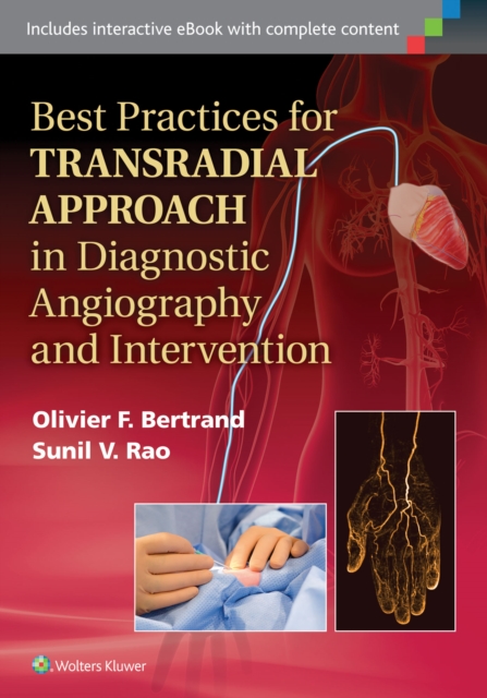【预订】Best Practices for Transradial Approach in Diagnostic Angiography and Intervention