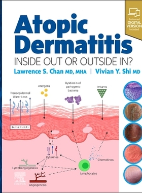 【预订】Atopic Dermatitis: Inside Out or Outside in 9780323847445