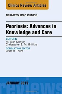 【预订】Psoriasis