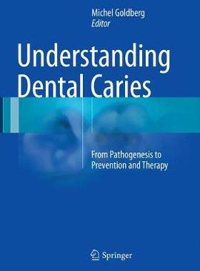 【预订】Understanding Dental Caries