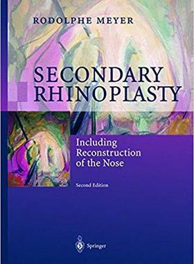 【预订】Secondary Rhinoplasty