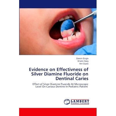 预订 Evidence on Effectivness of Silver Diamine Fluoride on Dentinal Caries 氟化二胺银*牙本质龋疗效的证据: 9786207841