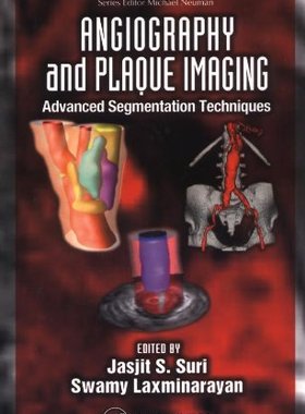 【预订】Angiography and Plaque Imaging