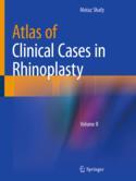 【预订】Atlas of Clinical Cases in Rhinoplasty: Volume II 9783031122705