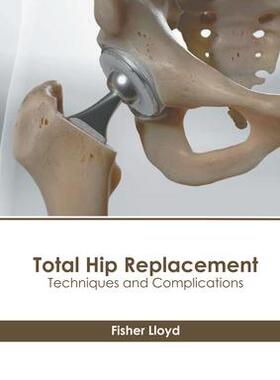 [预订]Total Hip Replacement: Techniques and Complications 9781639895267