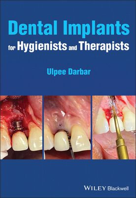 【预订】Dental Implants For Hygienists And Therapists 9781119763826
