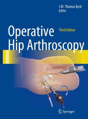 【预订】Operative Hip Arthroscopy