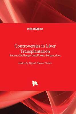 [预订]Controversies in Liver Transplantation - Recent Challenges and Future Perspectives 9781803560717